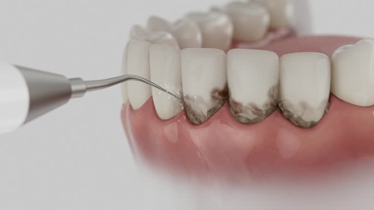 Reliable Dental Implants contractor in Fort Irwin, CA by Smile Center Dentistry